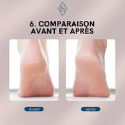 LIME ÉLECTRIQUE PROFESSIONNELLE