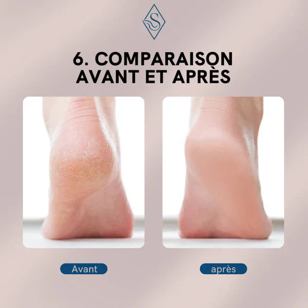 LIME ÉLECTRIQUE PROFESSIONNELLE